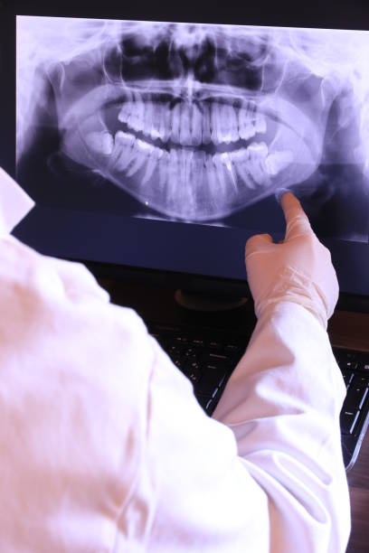 Best Broken Tooth Emergency  in Samoset, FL
