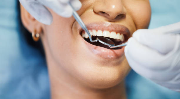 Best Root Canal Emergency Dentist  in Samoset, FL